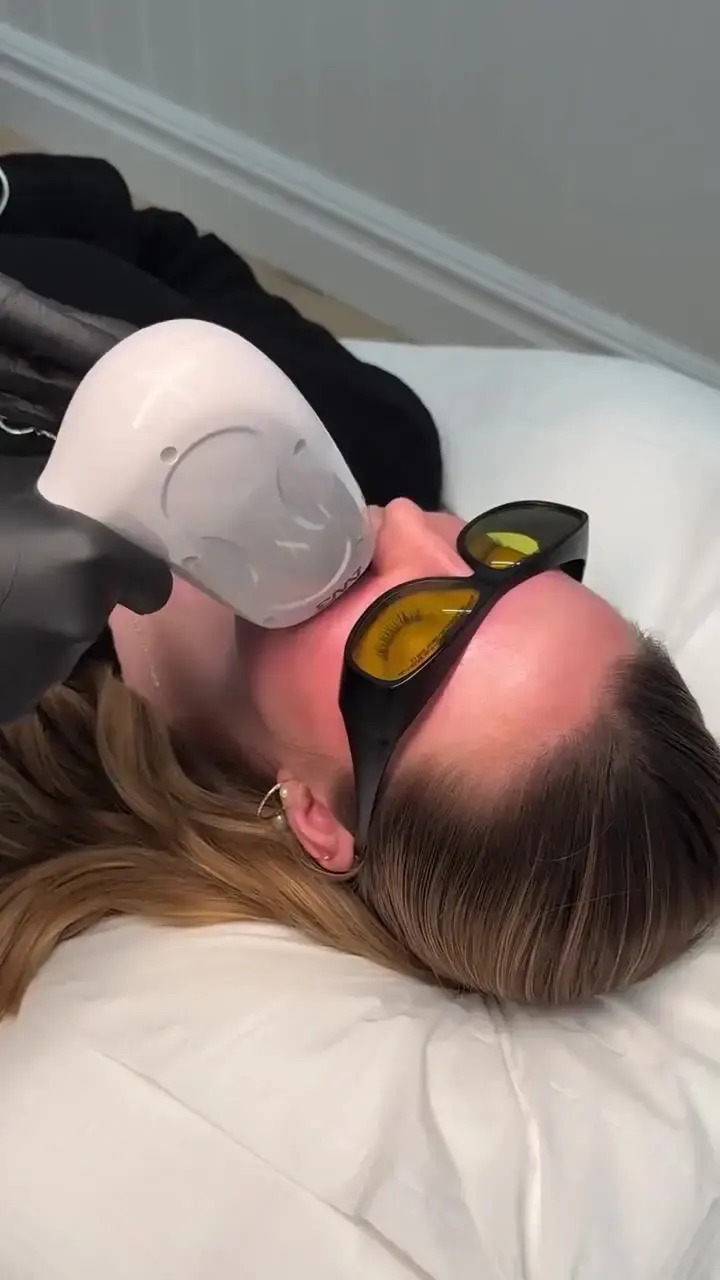 Sessão de laser com óculos de proteção